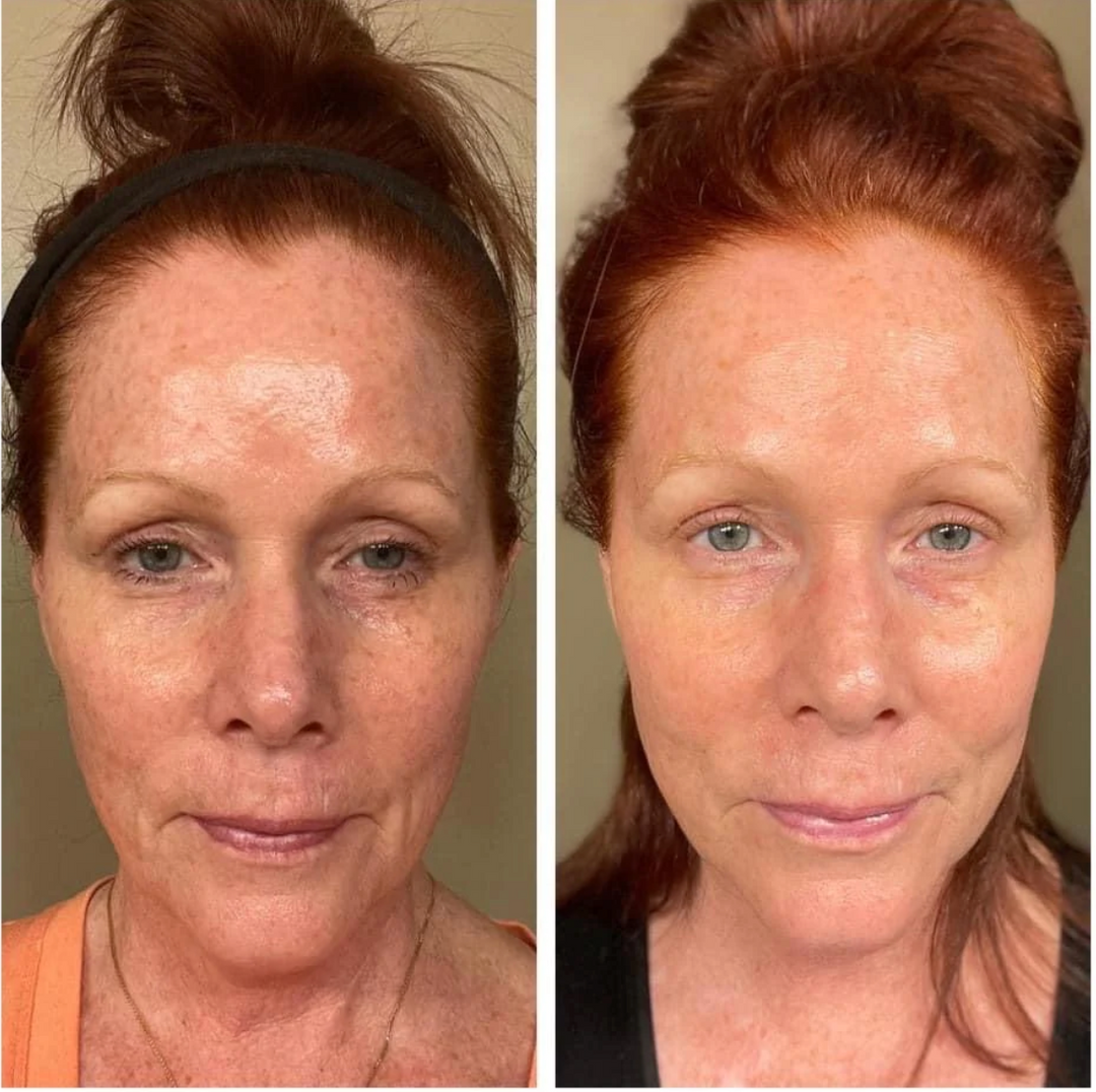 Beauty Focus Collagen + Peach – Every Day with Tracey