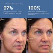 ageLOC Tru Face Peptide Retinol