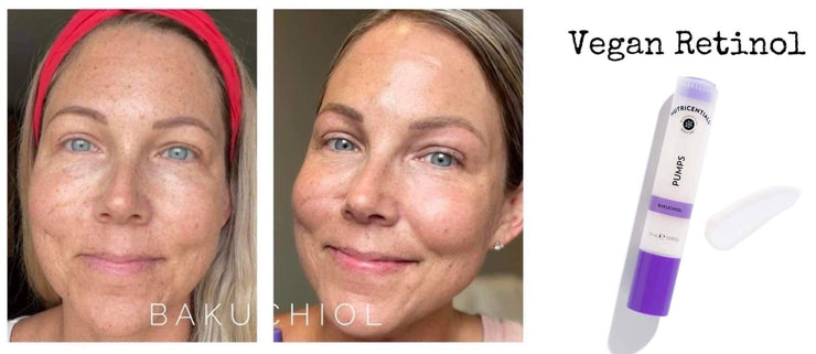 Bundle #13 - Bakuchiol & AHA Peel